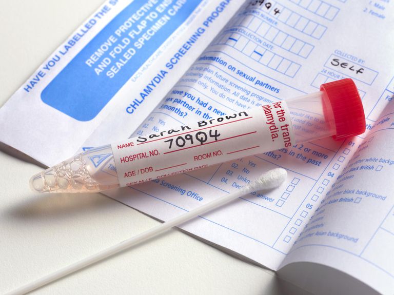 How Often Should You Get an STD Test
