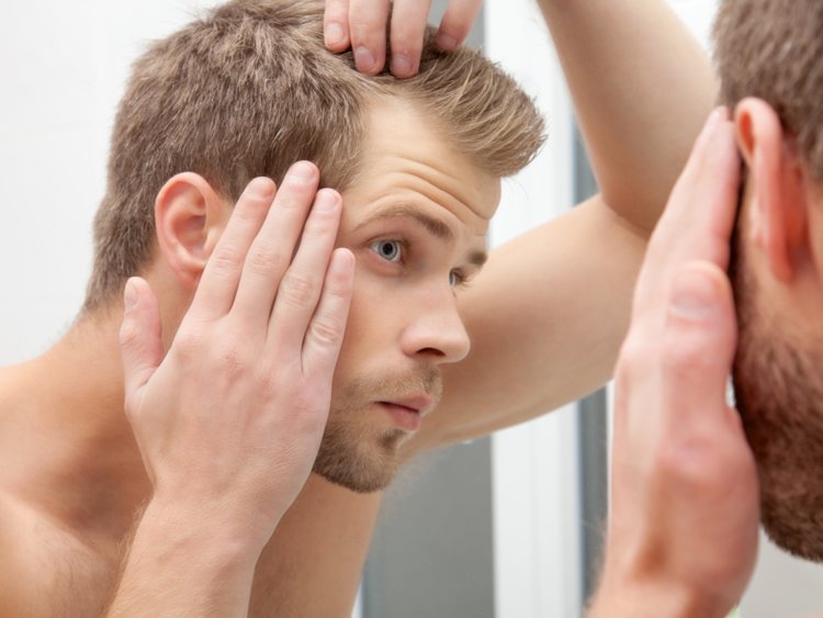 9 Possible Reasons Why You’ve Started Losing Your Hair