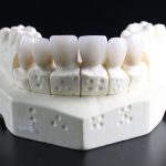 implants or dentures