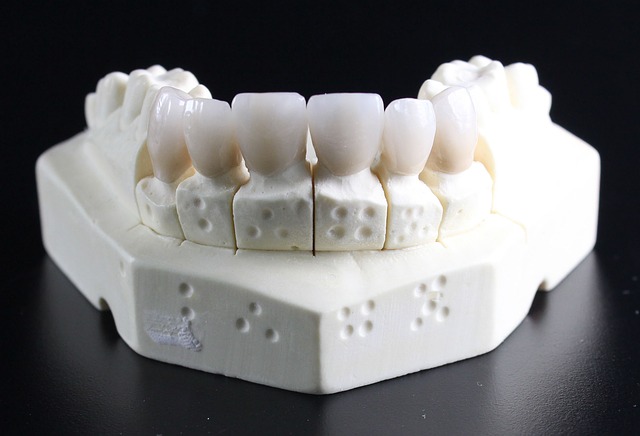 implants or dentures
